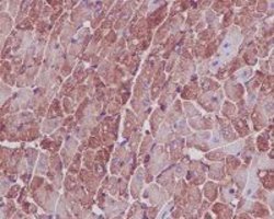 ACTA1 Rabbit anti-Human, Mouse, Rat, Unconjugated, Clone: BE-1, Abnova