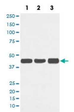 ACTA1 Rabbit anti-Human, Mouse, Rat, Unconjugated, Clone: AAOG-1, Abnova