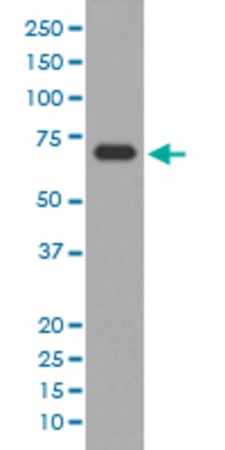 ALAS1 Rabbit anti-Human, Unconjugated, Clone: EOA-1 , Abnova 100 &mu;g;