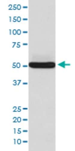 SGCA Rabbit anti-Human, Mouse, Rat, Unconjugated, Clone: ABGE-19 , Abnova