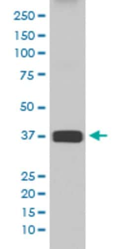 ARG1 Rabbit anti-Human, Mouse, Rat, Unconjugated, Clone: ADG-1, Abnova