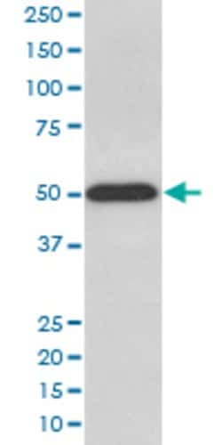 ATP5B Rabbit anti-Human, Mouse, Rat, Unconjugated, Clone: AADH-1 , Abnova