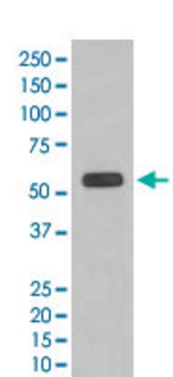 CASP8 Rabbit anti-Human, Unconjugated, Clone: GAI-3, Abnova 100 &mu;g | Buy Online | Abnova Corporation | Fisher Scientific