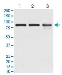 JUP Rabbit anti-Human, Mouse, Rat, Unconjugated, Clone: AOBD-10, Abnova