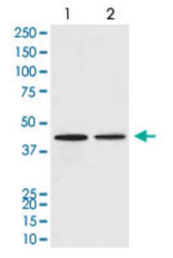 CCR9 Rabbit anti-Human, Mouse, Rat, Unconjugated, Clone: AAO-3, Abnova