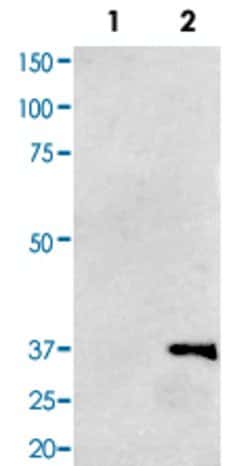 PA2140 Mouse anti-P. aeruginosa, HRP, Clone: 1F5, Abnova 100 &mu;g; HRP:Antibodies,