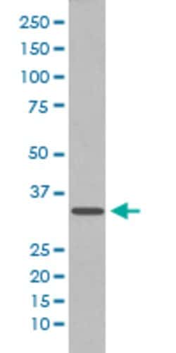 CDC2 Rabbit anti-Human, Unconjugated, Clone: BOI-3, Abnova 100 &mu;g; Unconjugated:Antibodies,
