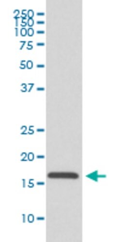 COX4I1 Rabbit anti-Human, Unconjugated, Clone: AIC-3, Abnova 100 &mu;g;