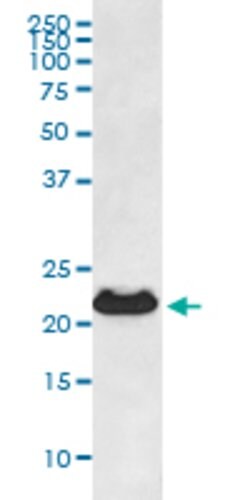 CRYAB Rabbit anti-Human, Unconjugated, Clone: ABHC-3, Abnova 100 &mu;g;