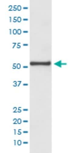 CCNA1 Rabbit anti-Human, Unconjugated, Clone: HOD-3, Abnova 100 &mu;g;