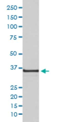 CCNH Rabbit anti-Human, Unconjugated, Clone: GII-3, Abnova 100 &mu;g; Unconjugated:Antibodies,