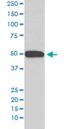KRT13 Rabbit anti-Human, Unconjugated, Clone: GAC-11, Abnova 100 &mu;g;