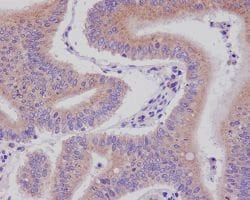 DNAJC15 Rabbit anti-Human, Unconjugated, Clone: CBC-4, Abnova 100 &mu;g;