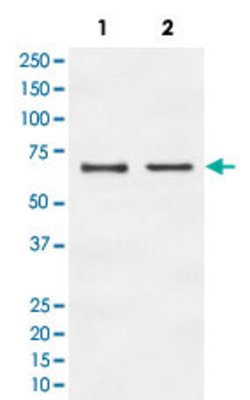 E2F1 Rabbit anti-Human, Unconjugated, Clone: IGD-5, Abnova 100 &mu;g; Unconjugated:Antibodies,
