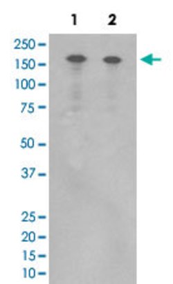 ERBB4 Rabbit anti-Human, Unconjugated, Clone: HC-5, Abnova 100 &mu;g; Unconjugated:Antibodies,