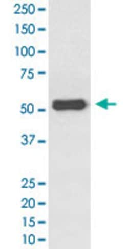 ESR2 Rabbit anti-Human, Unconjugated, Clone: IDI-5, Abnova 100 &mu;g | Buy Online | Abnova Corporation | Fisher Scientific