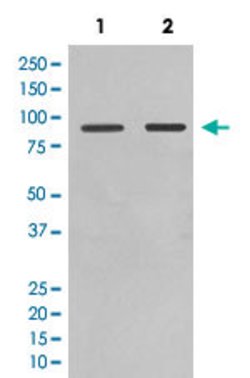FOXO1 Rabbit anti-Human, Unconjugated, Clone: CIA-6, Abnova 100 &mu;g | Buy Online | Abnova Corporation | Fisher Scientific