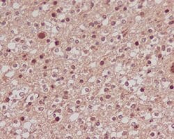 FOXO1 Rabbit anti-Human, Unconjugated, Clone: CIA-6, Abnova 100 &mu;g | Buy Online | Abnova Corporation | Fisher Scientific