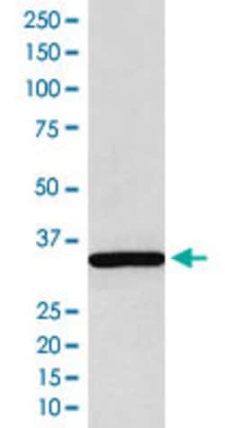 SGCG Rabbit anti-Human, Unconjugated, Clone: AbS34, Abnova 100 &mu;g; Unconjugated:Antibodies,