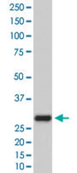 GFP Rabbit anti-Human, Unconjugated, Clone: CD-7, Abnova 100 &mu;g; Unconjugated:Antibodies,