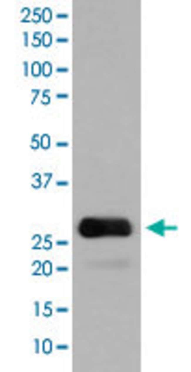 GFP Rabbit anti-Human, Unconjugated, Clone: CE-7, Abnova 100 μg ...