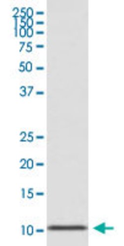 GCG Rabbit anti-Human, Unconjugated, Clone: AOHH-7, Abnova 100 &mu;g; Unconjugated:Antibodies,