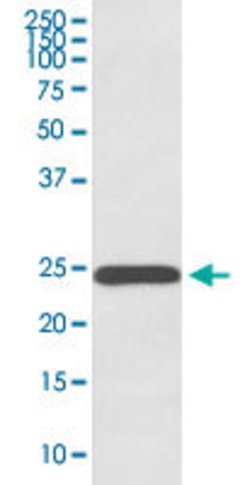 GH1 Rabbit anti-Human, Unconjugated, Clone: AADG-7, Abnova 100 &mu;g | Buy Online | Abnova Corporation | Fisher Scientific