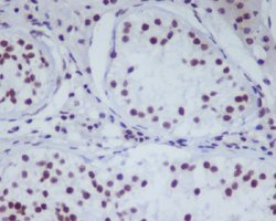 HDAC1 Rabbit anti-Human, Unconjugated, Clone: AIB-8, Abnova 100 &mu;g;