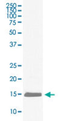 HBA1 Rabbit anti-Human, Unconjugated, Clone: EGI-8, Abnova 100 &mu;g; Unconjugated:Antibodies,