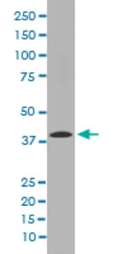 MMP12 Rabbit anti-Human, Unconjugated, Clone: CHE-13, Abnova 100 &mu;g;