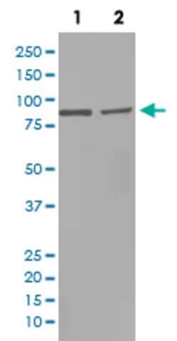 MMP9 Rabbit anti-Human, Rat, Unconjugated, Clone: BCD-13, Abnova 100 &mu;g;