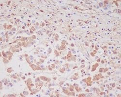 MMP9 Rabbit anti-Human, Rat, Unconjugated, Clone: BCD-13, Abnova 100 &mu;g;