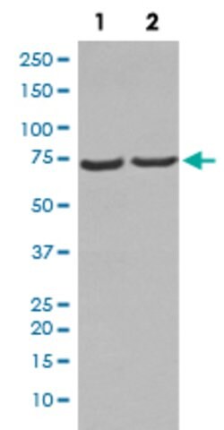 NGFR Rabbit anti-Human, Rat, Unconjugated, Clone: DBO-14, Abnova 100 &mu;g | Buy Online | Abnova Corporation | Fisher Scientific
