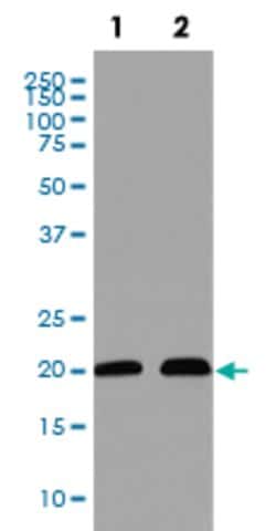CDKN1A Rabbit anti-Human, Unconjugated, Clone: ACG-3, Abnova 100 &mu;g;