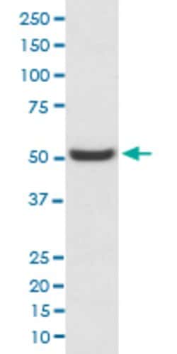PDIA6 Rabbit anti-Human, Unconjugated, Clone: AOBE-16, Abnova 100 &mu;g;