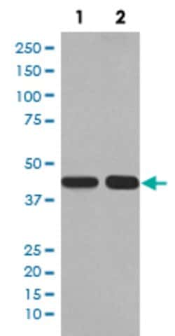 PGK1 Rabbit anti-Human, Mouse, Unconjugated, Clone: EAB-16, Abnova 100
