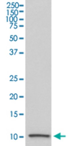 IGF2 Rabbit anti-Human, Unconjugated, Clone: IGE-9, Abnova 100 &mu;g; Unconjugated:Antibodies,