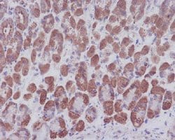 NFKBIA Rabbit anti-Human, Unconjugated, Clone: HO-14, Abnova 100 &mu;g;