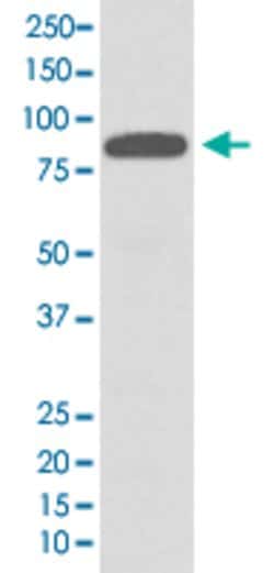 CHUK Rabbit anti-Human, Unconjugated, Clone: FCC-3, Abnova 100 &mu;g | Buy Online | Abnova Corporation | Fisher Scientific