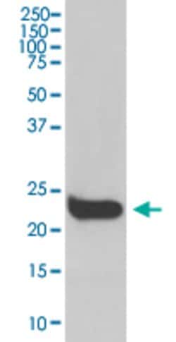 IFNB1 Rabbit anti-Human, Unconjugated, Clone: AOHB-9, Abnova 100 &mu;g;