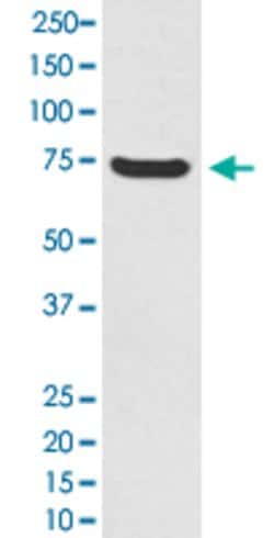 MAP3K2 Rabbit anti-Human, Unconjugated, Clone: FHC-13, Abnova 100 &mu;g;