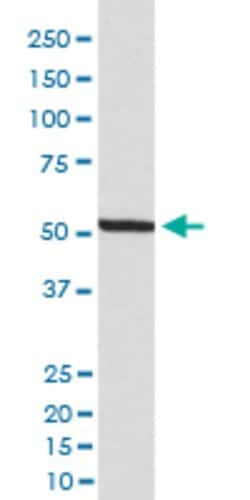IRF3 Rabbit anti-Human, Unconjugated, Clone: IGO-9, Abnova 100 &mu;g; Unconjugated:Antibodies,