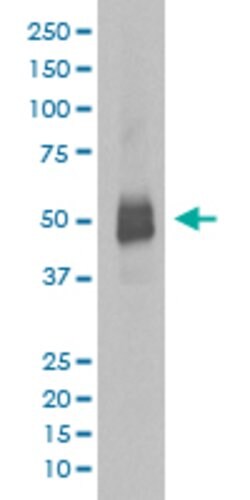 LYN Rabbit anti-Human, Unconjugated, Clone: IFI-12, Abnova 100 &mu;g; Unconjugated:Antibodies,