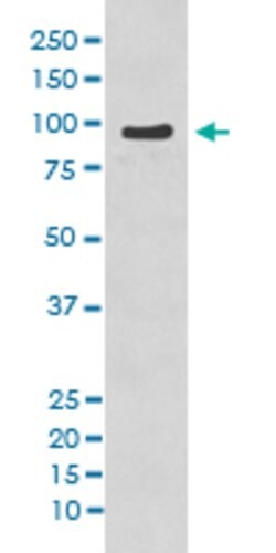 NBN Rabbit anti-Human, Unconjugated, Clone: BGI-14, Abnova 100 &mu;g; Unconjugated:Antibodies,