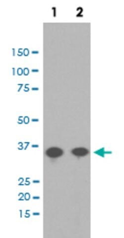 PPP2CA Rabbit anti-Human, Rat, Unconjugated, Clone: AAA-16, Abnova 100