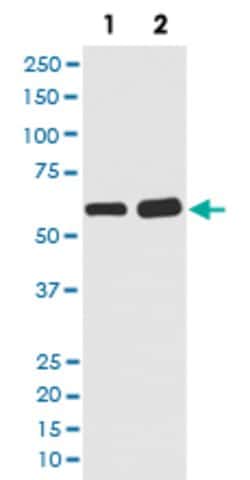 SMAD5 Rabbit anti-Human, Mouse, Rat, Unconjugated, Clone: AFB-19, Abnova