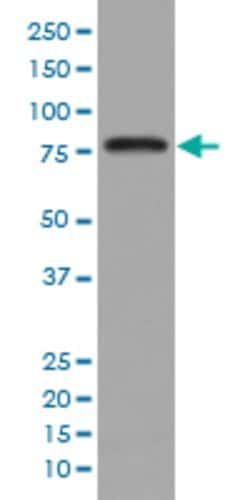 PRKCB Rabbit anti-Human, Unconjugated, Clone: DOC-16, Abnova 100 &mu;g | Buy Online | Abnova Corporation | Fisher Scientific