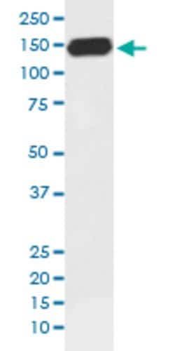PLCG1 Rabbit anti-Human, Unconjugated, Clone: FAA-16, Abnova 100 &mu;g;