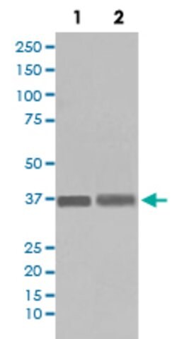 PPP1CA Rabbit anti-Human, Unconjugated, Clone: AFC-16, Abnova 100 &mu;g | Buy Online | Abnova Corporation | Fisher Scientific