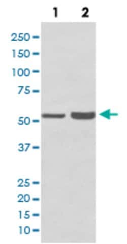 PRPF19 Rabbit anti-Human, Mouse, Unconjugated, Clone: FEC-16, Abnova 100